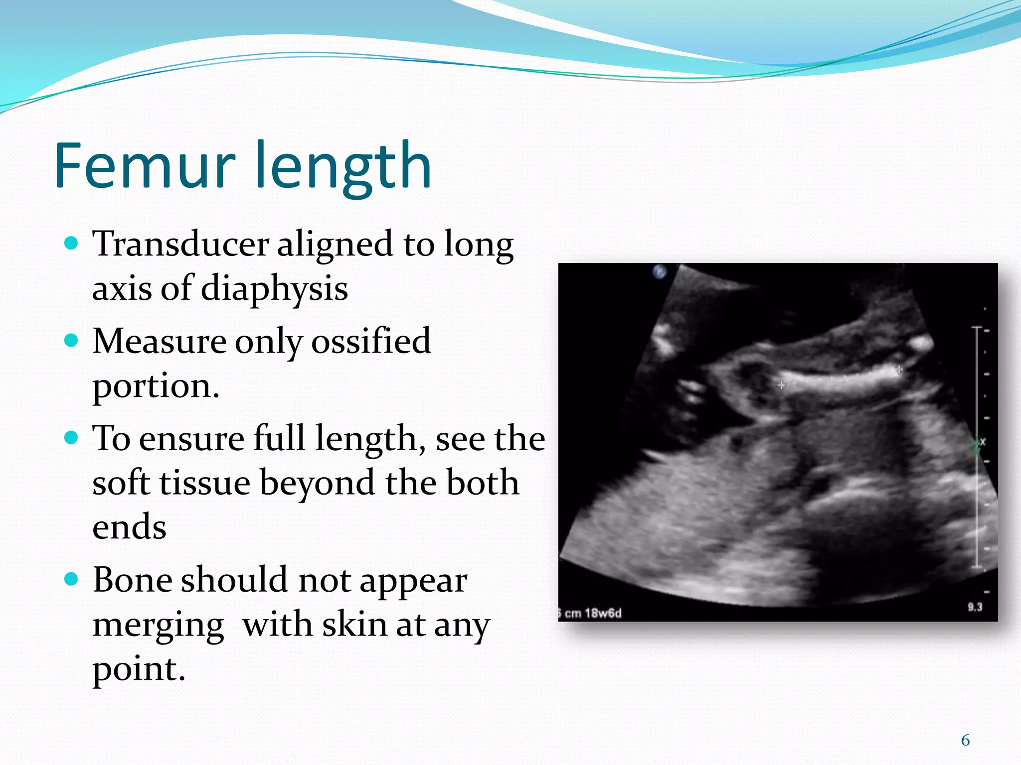 Femur length
 Transducer aligned to long
  axis of diaphysis
                                   Image
 Measure only ossified
  portion.
 To ensure full length, see the
  soft tissue beyond the both
  ends
 Bone should not appear
  merging with skin at any
  point.
                                           6
 
