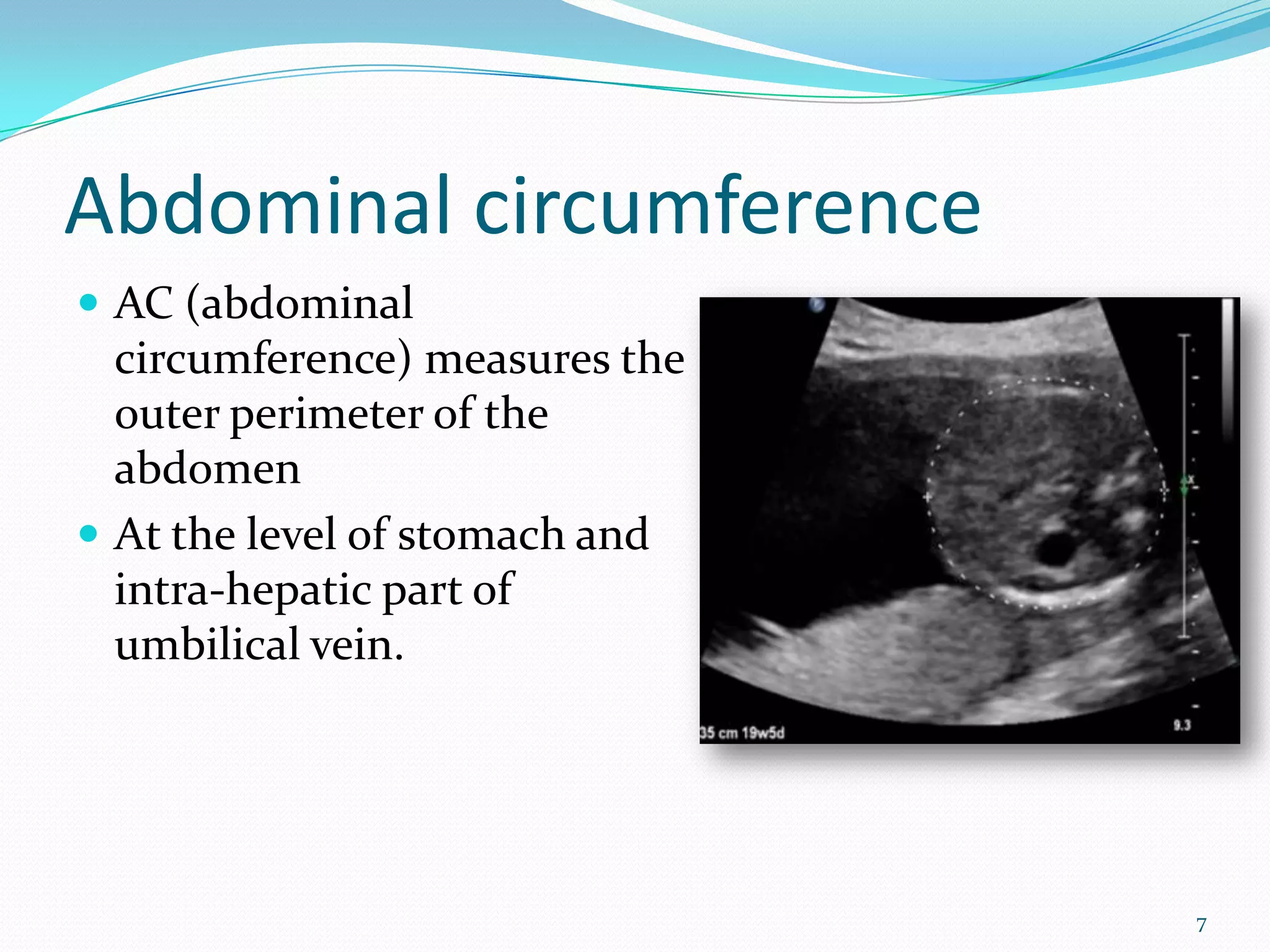 Abdominal circumference
 AC (abdominal
  circumference) measures the
  outer perimeter of the        Image
  abdomen
 At the level of stomach and
  intra-hepatic part of
  umbilical vein.




                                        7
 