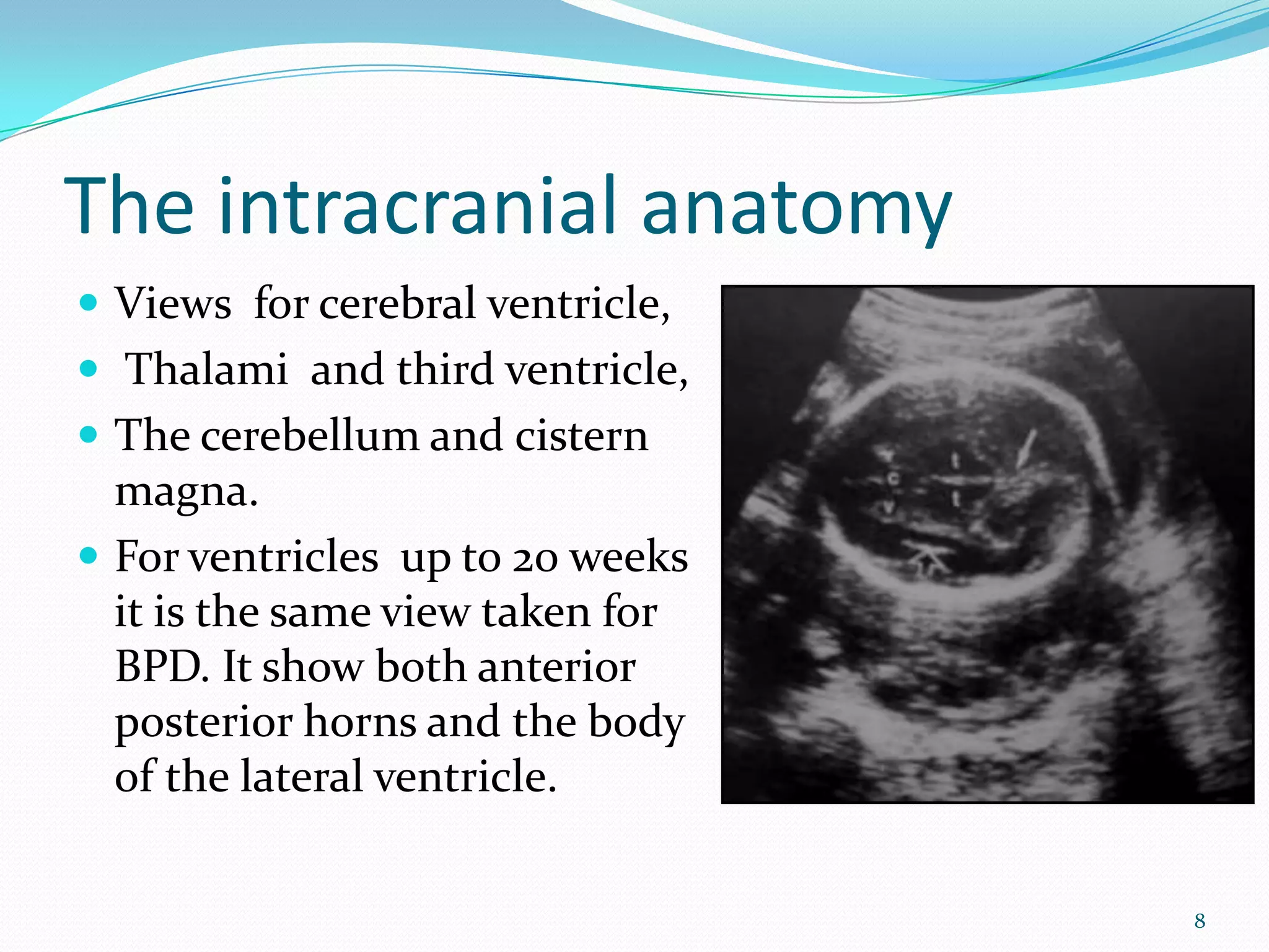 The intracranial anatomy
 Views for cerebral ventricle,
 Thalami and third ventricle,
 The cerebellum and cistern
  magna.
 For ventricles up to 20 weeks
  it is the same view taken for
  BPD. It show both anterior
  posterior horns and the body
  of the lateral ventricle.

                                  8
 