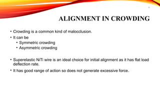 19
ALIGNMENT IN CROWDING
• Crowding is a common kind of malocclusion.
• It can be
• Symmetric crowding
• Asymmetric crowding
• Superelastic NiTi wire is an ideal choice for initial alignment as it has flat load
deflection rate.
• It has good range of action so does not generate excessive force.
 