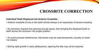 25
CROSSBITE CORRECTION
Individual Teeth Displaced into Anterior Crossbite:
• Anterior crossbite of one or two teeth almost always is an expression of severe crowding.
• Its correction requires first opening enough space, then bringing the displaced tooth or
teeth across the occlusion into proper position.
• To avoid occlusal interferences, bite blocks may be used temporarily. (usually on lower
1st molars)
• During rapid growth in early adolescence, opening the bite may not be required.
 