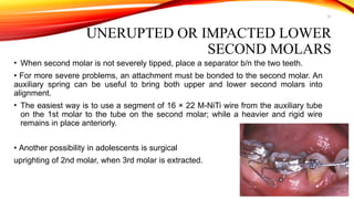 31
UNERUPTED OR IMPACTED LOWER
SECOND MOLARS
• When second molar is not severely tipped, place a separator b/n the two teeth.
• For more severe problems, an attachment must be bonded to the second molar. An
auxiliary spring can be useful to bring both upper and lower second molars into
alignment.
• The easiest way is to use a segment of 16 × 22 M-NiTi wire from the auxiliary tube
on the 1st molar to the tube on the second molar; while a heavier and rigid wire
remains in place anteriorly.
• Another possibility in adolescents is surgical
uprighting of 2nd molar, when 3rd molar is extracted.
 