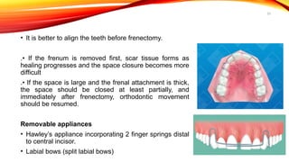 33
• It is better to align the teeth before frenectomy.
.• If the frenum is removed first, scar tissue forms as
healing progresses and the space closure becomes more
difficult
.• If the space is large and the frenal attachment is thick,
the space should be closed at least partially, and
immediately after frenectomy, orthodontic movement
should be resumed.
Removable appliances
• Hawley’s appliance incorporating 2 finger springs distal
to central incisor.
• Labial bows (split labial bows)
 