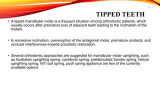 38
TIPPED TEETH
• A tipped mandibular molar is a frequent situation among orthodontic patients, which
usually occurs after premature loss of adjacent teeth leading to the inclination of the
molars.
• In excessive inclination, overeruption of the antagonist molar, premature contacts, and
occlusal interferences impede prosthetic restoration.
• Several orthodontic approaches are suggested for mandibular molar uprighting, such
as Australian uprighting spring, cantilever spring, prefabricated Sander spring, helical
uprighting spring, NiTi coil spring, push spring appliance are few of the currently
available options
 