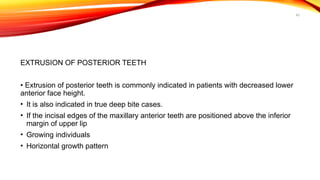 43
EXTRUSION OF POSTERIOR TEETH
• Extrusion of posterior teeth is commonly indicated in patients with decreased lower
anterior face height.
• It is also indicated in true deep bite cases.
• If the incisal edges of the maxillary anterior teeth are positioned above the inferior
margin of upper lip
• Growing individuals
• Horizontal growth pattern
 