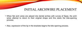 47
INITIAL ARCHWIRE PLACEMENT
• When flat arch wires are placed into dental arches with curves of Spee, the arch
wires attempt to return to their original shape and this starts the bite-opening
process.
• Also, expression of the tip in the brackets begins the bite opening process.
 