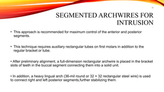 56
SEGMENTED ARCHWIRES FOR
INTRUSION
• This approach is recommended for maximum control of the anterior and posterior
segments.
• This technique requires auxillary rectangular tubes on first molars in addition to the
regular bracket or tube.
• After preliminary alignment, a full-dimension rectangular archwire is placed in the bracket
slots of teeth in the buccal segment connecting them into a solid unit.
• In addition, a heavy lingual arch (36-mil round or 32 × 32 rectangular steel wire) is used
to connect right and left posterior segments,further stabilizing them.
 