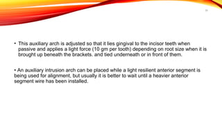 59
• This auxiliary arch is adjusted so that it lies gingival to the incisor teeth when
passive and applies a light force (10 gm per tooth) depending on root size when it is
brought up beneath the brackets. and tied underneath or in front of them.
• An auxiliary intrusion arch can be placed while a light resilient anterior segment is
being used for alignment, but usually it is better to wait until a heavier anterior
segment wire has been installed.
 