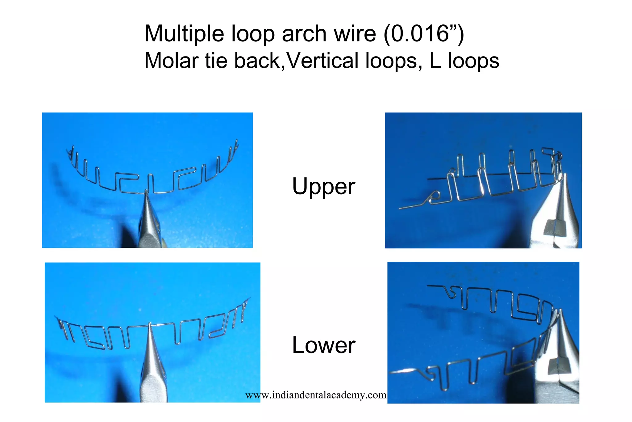 Multiple loop arch wire (0.016”)
Molar tie back,Vertical loops, L loops
Upper
Lower
www.indiandentalacademy.com
 
