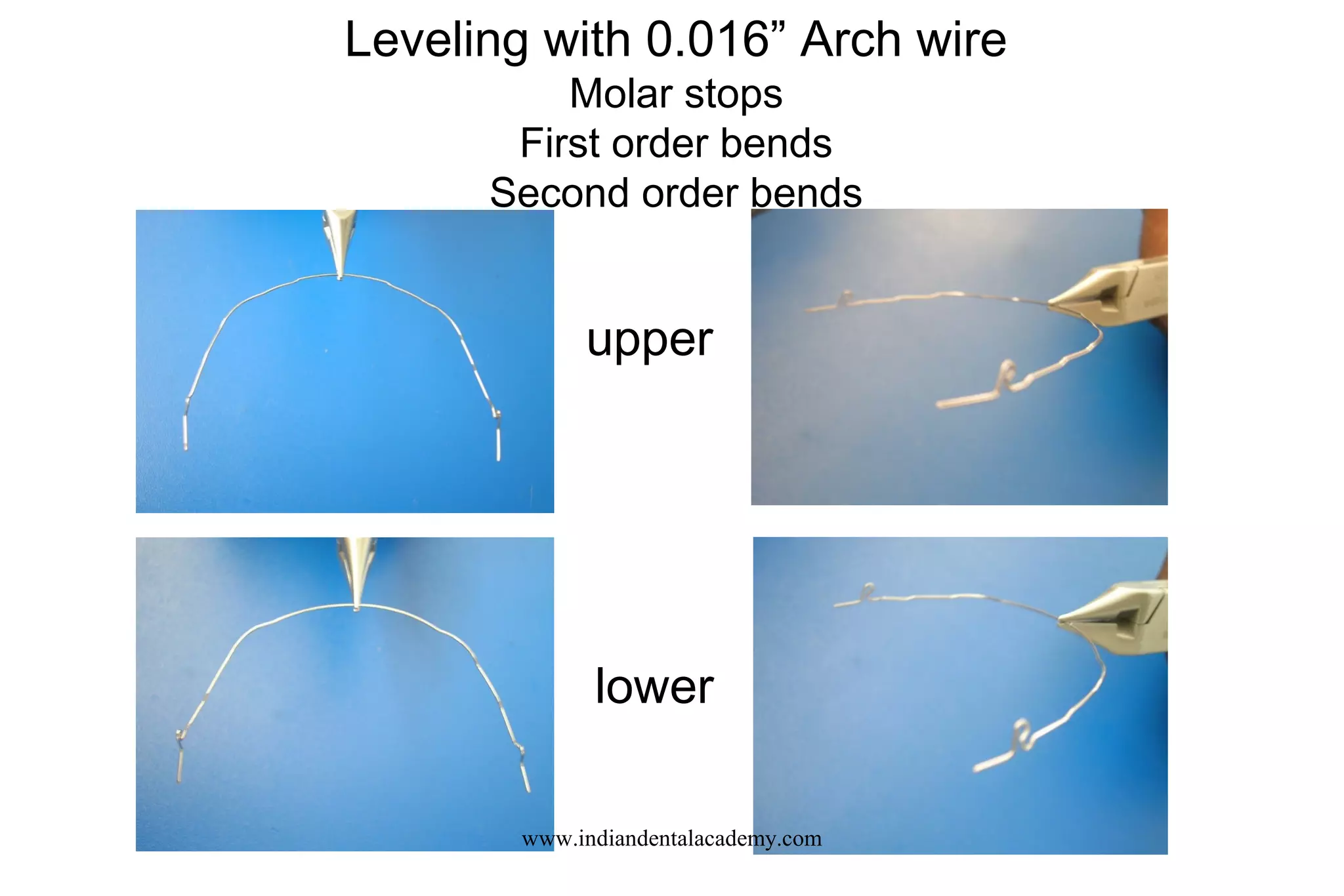 Leveling with 0.016” Arch wire
Molar stops
First order bends
Second order bends
upper
lower
www.indiandentalacademy.com
 