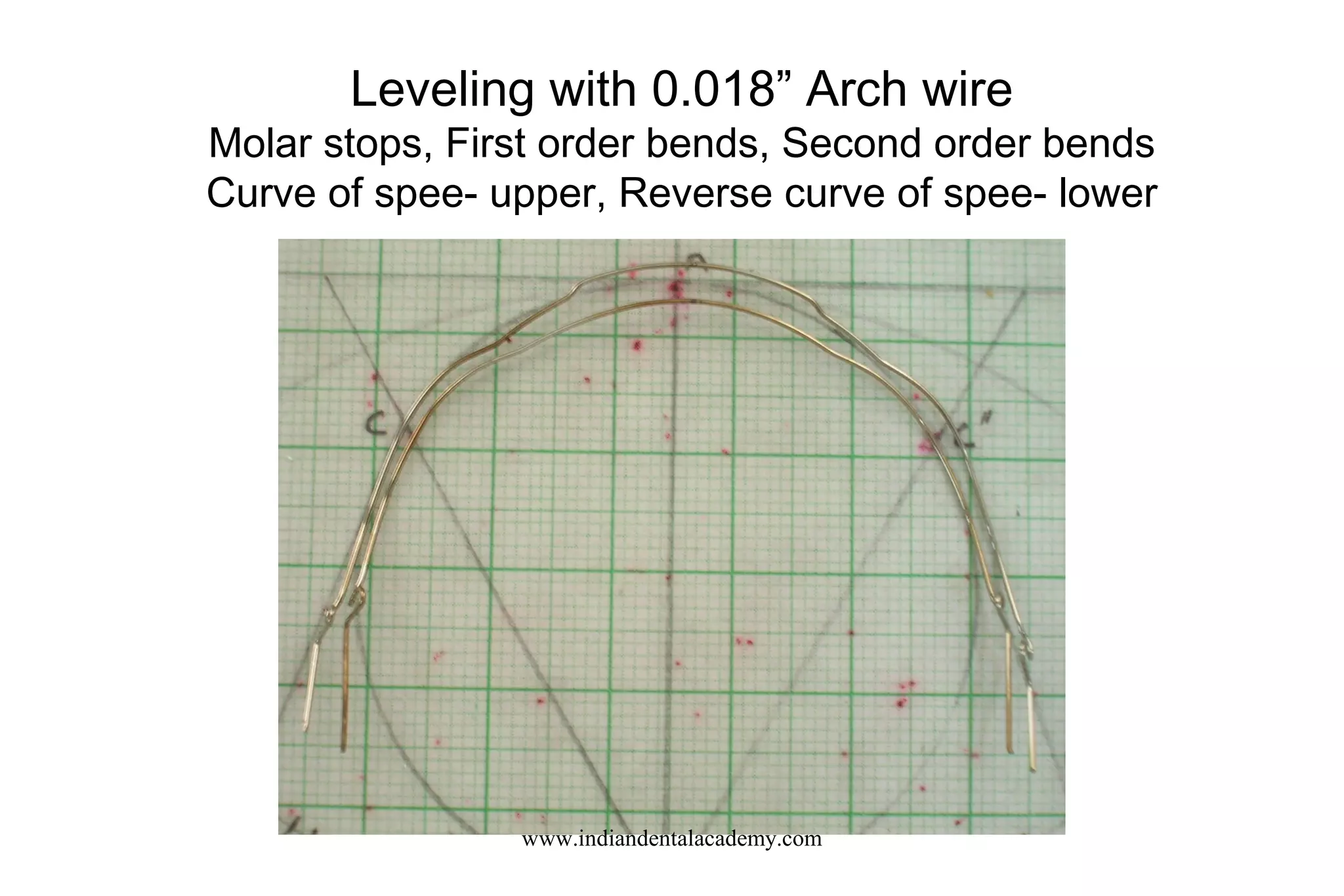 Leveling with 0.018” Arch wire
Molar stops, First order bends, Second order bends
Curve of spee- upper, Reverse curve of spee- lower
www.indiandentalacademy.com
 