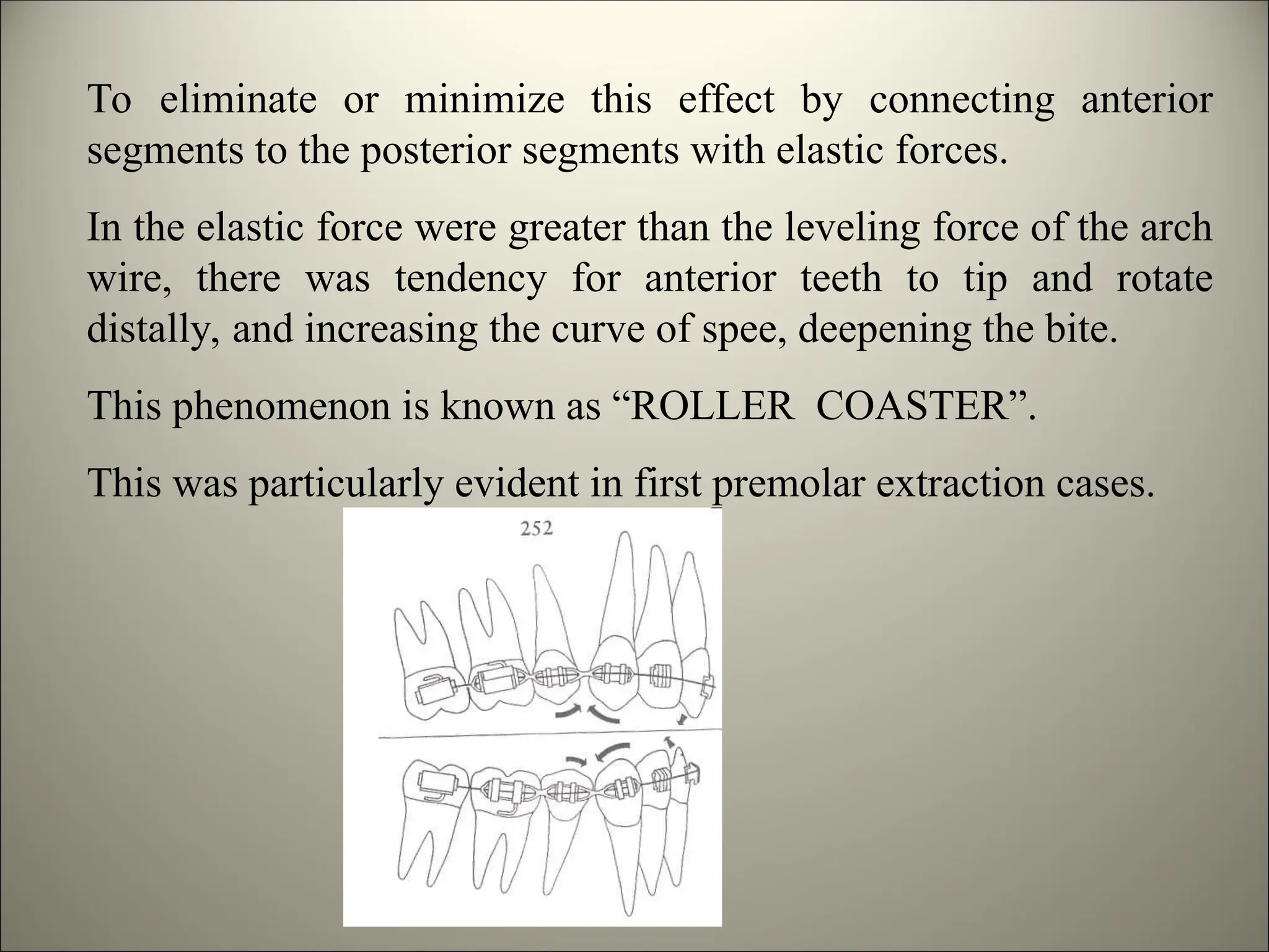To eliminate or minimize this effect by connecting anterior
segments to the posterior segments with elastic forces.
In the elastic force were greater than the leveling force of the arch
wire, there was tendency for anterior teeth to tip and rotate
distally, and increasing the curve of spee, deepening the bite.
This phenomenon is known as “ROLLER COASTER”.
This was particularly evident in first premolar extraction cases.
 
