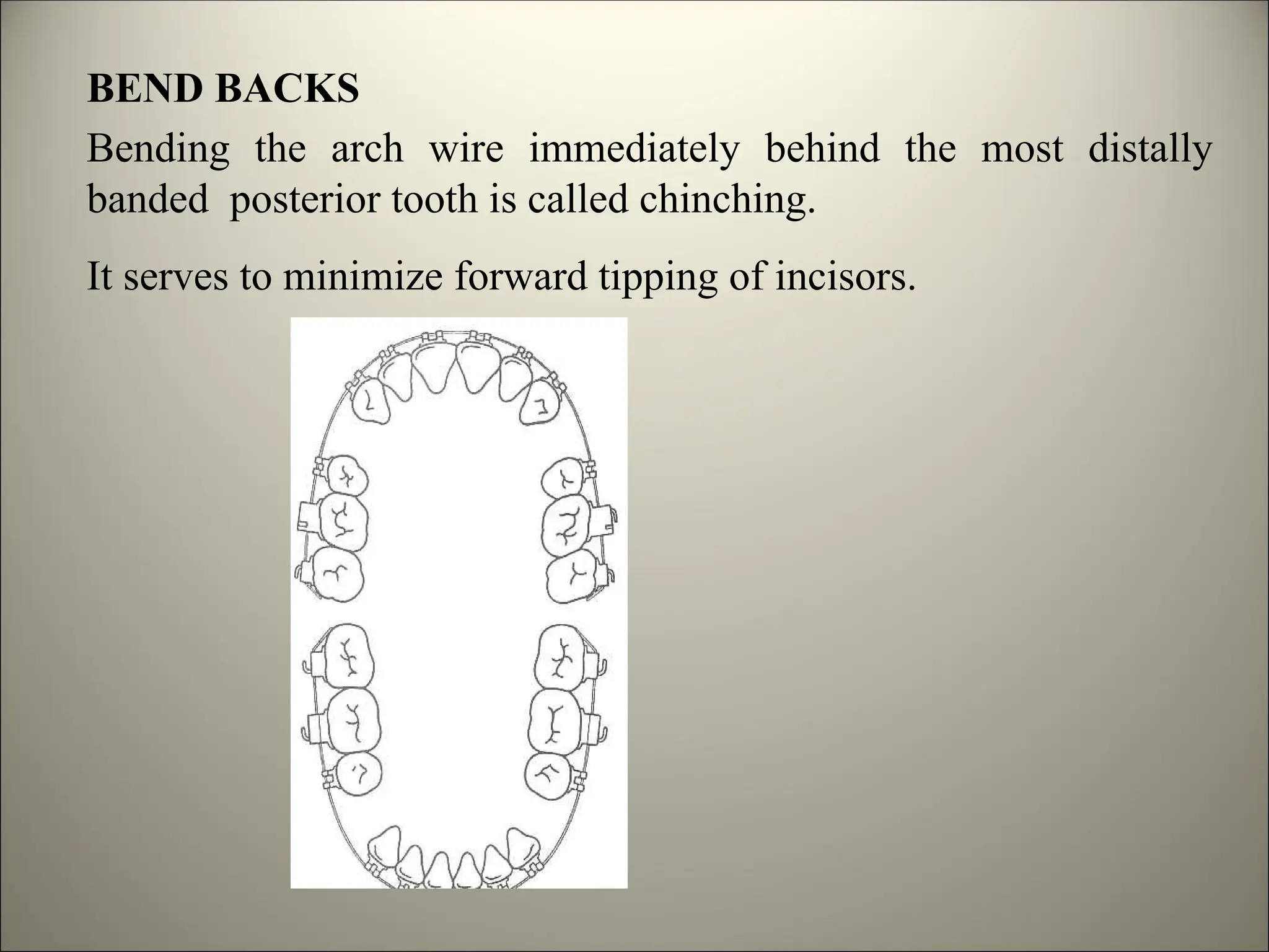 BEND BACKS
Bending the arch wire immediately behind the most distally
banded posterior tooth is called chinching.
It serves to minimize forward tipping of incisors.
 