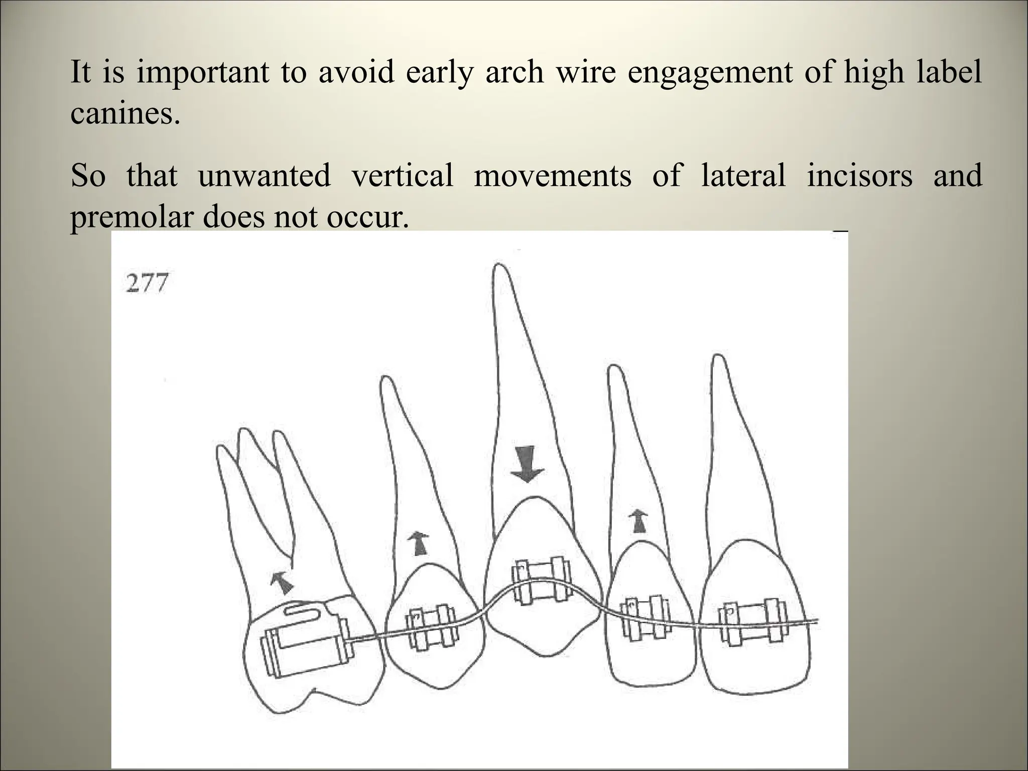 It is important to avoid early arch wire engagement of high label
canines.
So that unwanted vertical movements of lateral incisors and
premolar does not occur.
 