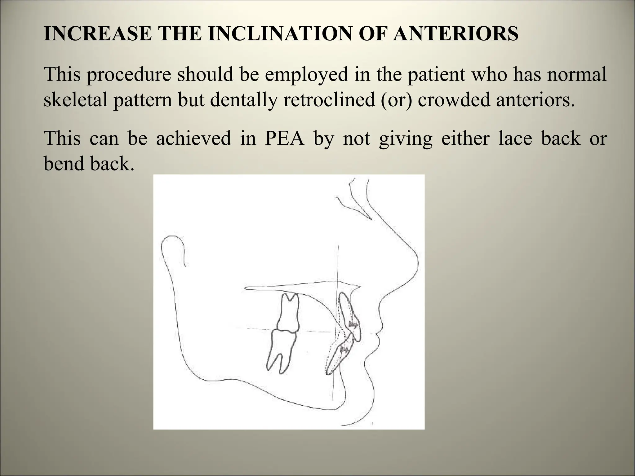 INCREASE THE INCLINATION OF ANTERIORS
This procedure should be employed in the patient who has normal
skeletal pattern but dentally retroclined (or) crowded anteriors.
This can be achieved in PEA by not giving either lace back or
bend back.
 