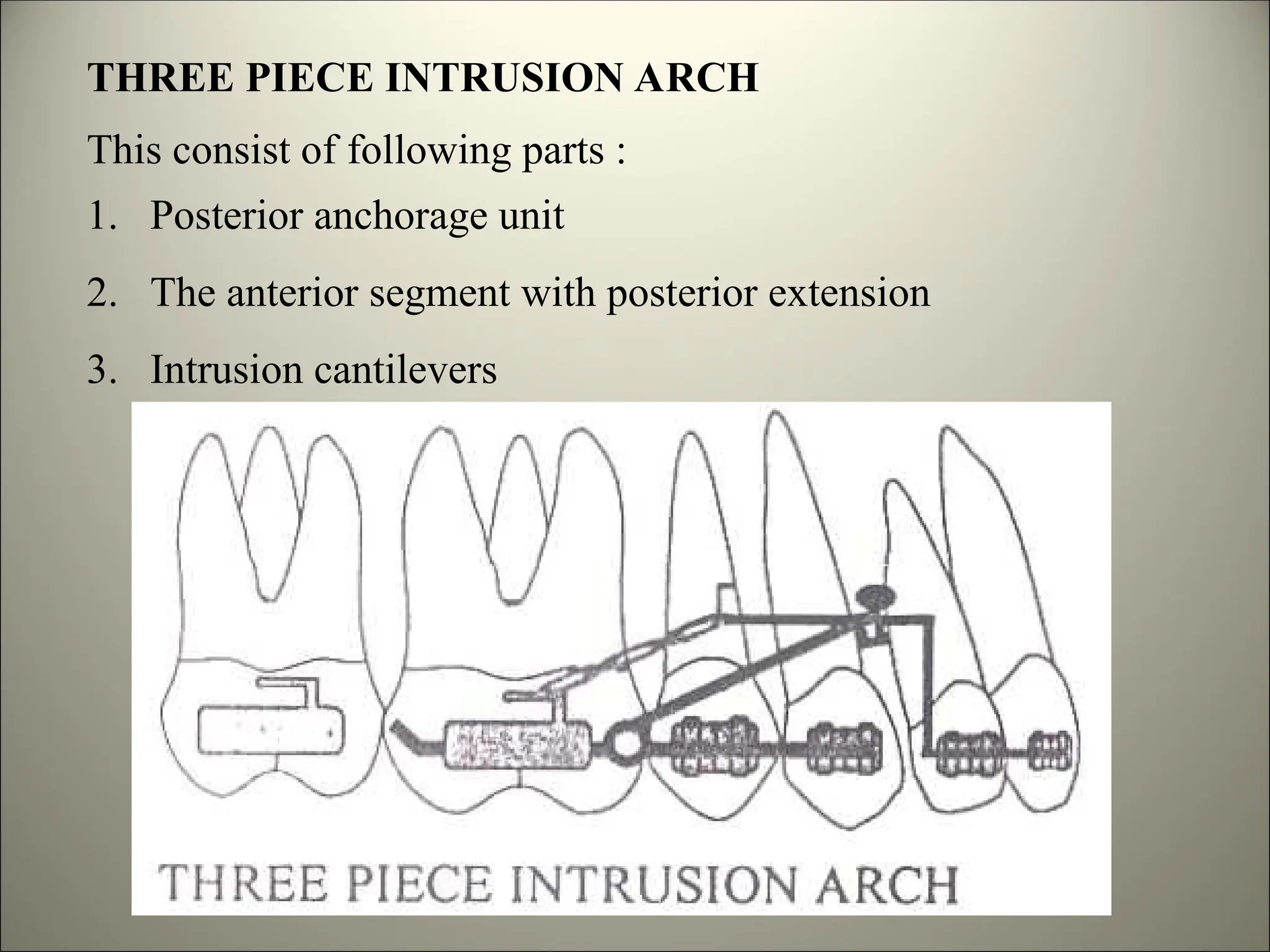 THREE PIECE INTRUSION ARCH
This consist of following parts :
1. Posterior anchorage unit
2. The anterior segment with posterior extension
3. Intrusion cantilevers
 