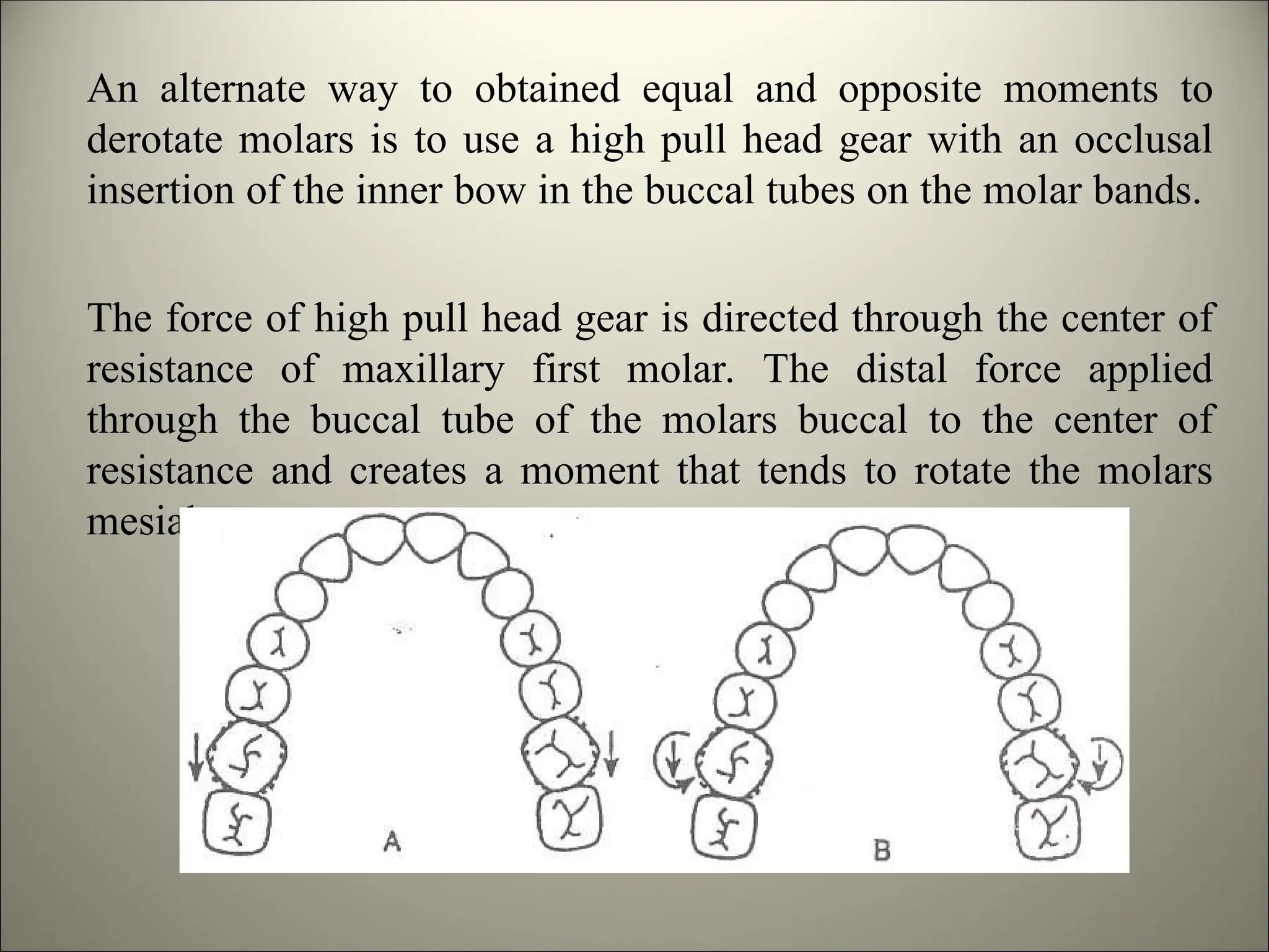 An alternate way to obtained equal and opposite moments to
derotate molars is to use a high pull head gear with an occlusal
insertion of the inner bow in the buccal tubes on the molar bands.
The force of high pull head gear is directed through the center of
resistance of maxillary first molar. The distal force applied
through the buccal tube of the molars buccal to the center of
resistance and creates a moment that tends to rotate the molars
mesial out.
 