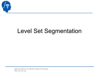 Level Set Segmentation 