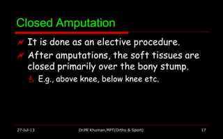 Closed Amputation
27-Jul-13 Dr.PR Khuman,MPT(Ortho & Sport) 17
 It is done as an elective procedure.
 After amputations, the soft tissues are
closed primarily over the bony stump.
 E.g., above knee, below knee etc.
 