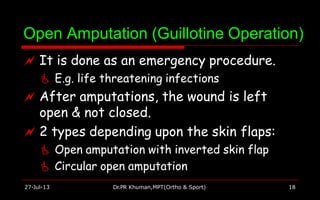 Open Amputation (Guillotine Operation)
27-Jul-13 Dr.PR Khuman,MPT(Ortho & Sport) 18
 It is done as an emergency procedure.
 E.g. life threatening infections
 After amputations, the wound is left
open & not closed.
 2 types depending upon the skin flaps:
 Open amputation with inverted skin flap
 Circular open amputation
 