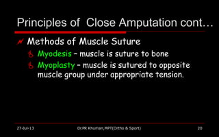 Principles of Close Amputation cont…
27-Jul-13 Dr.PR Khuman,MPT(Ortho & Sport) 20
 Methods of Muscle Suture
 Myodesis – muscle is suture to bone
 Myoplasty – muscle is sutured to opposite
muscle group under appropriate tension.
 