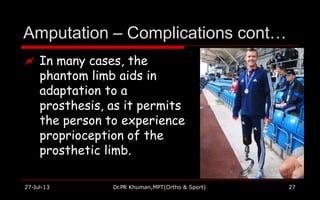 Amputation – Complications cont…
27-Jul-13 Dr.PR Khuman,MPT(Ortho & Sport) 27
 In many cases, the
phantom limb aids in
adaptation to a
prosthesis, as it permits
the person to experience
proprioception of the
prosthetic limb.
 