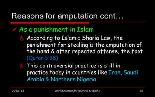 Reasons for amputation cont…
27-Jul-13 Dr.PR Khuman,MPT(Ortho & Sport) 36
 As a punishment in Islam
 According to Islamic Sharia Law, the
punishment for stealing is the amputation of
the hand & after repeated offense, the foot
(Quran 5:38)
 This controversial practice is still in
practice today in countries like Iran, Saudi
Arabia & Northern Nigeria.
 
