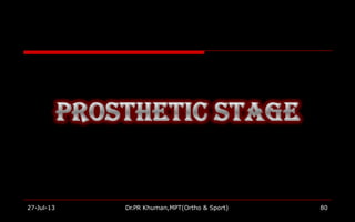 27-Jul-13 Dr.PR Khuman,MPT(Ortho & Sport) 80
 