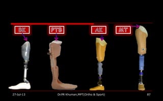 27-Jul-13 Dr.PR Khuman,MPT(Ortho & Sport) 87
 