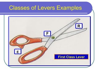 Classes of Levers Examples
E
F
R
First Class Lever
 