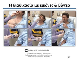 Η διαδικασία με εικόνες & βίντεο
Nasogastric tube insertion
“Nasogastric tube insertion”, από CliniSnips
διαθέσιμο με άδεια Creative Commons licensing -
attribution, non-commercial, share-alike 19
 