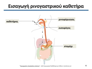 Εισαγωγή ρινογαστρικού καθετήρα
ρινοφάρυγγας
οισοφάγος
στομάχι
καθετήρας
“Nasogastric intubation schema”, από Nanoxyde διαθέσιμο με άδεια CC BY-SA 3.0 4
 