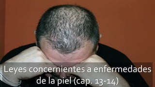 Leyes concernientes a enfermedades
de la piel (cap. 13-14)
 