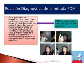    Estas posiciones de
    diferentes direcciones, son
    las denominadas posiciones                       PDM: acción simple
    diagnósticas de la mirada, que                   y máxima para cada
    son de 3 tipos: ducciones o
    movimientos monoculares,                         músculo.
    versiones o movimientos
    coordinados de ambos ojos
    hacia el mismo campo de la
    mirada, y vergencias o
    movimientos disyuntivos o no
    conjugados hacia direcciones
    opuestas.




                                     Ortoptica-UG John Alvarado
 