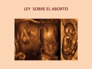 LEY  SOBRE EL ABORTO 