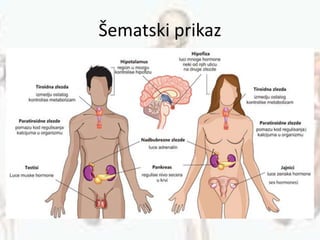 Šematski prikaz
 