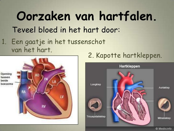 Lezing 20111116 hart en