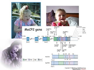 MeCP2 gene

 