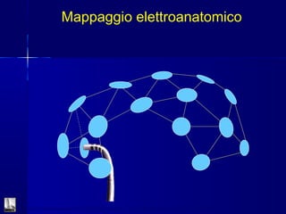 Mappaggio elettroanatomico
Malattie Cardiovascolari II – Ospedale S.Chiara – Azienda Ospedaliero Universitaria Pisana
 