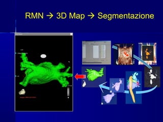 RMN  3D Map  Segmentazione
 