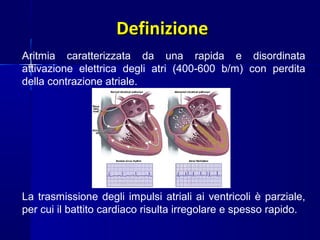 DefinizioneDefinizione
Aritmia caratterizzata da una rapida e disordinata
attivazione elettrica degli atri (400-600 b/m) con perdita
della contrazione atriale.
La trasmissione degli impulsi atriali ai ventricoli è parziale,
per cui il battito cardiaco risulta irregolare e spesso rapido.
 