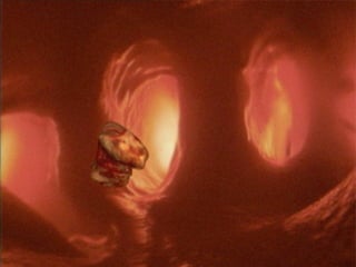 6. Thrombotic material in the aortic arch
(computer graphics superimposed on in-body
photograph)
Once fragments of the thrombus are in the blood stream
they may be carried to any part of the body. Small
fragments may result in a transient cerebral ischaemic
attack. Larger pieces may have more devastating
consequences.
 