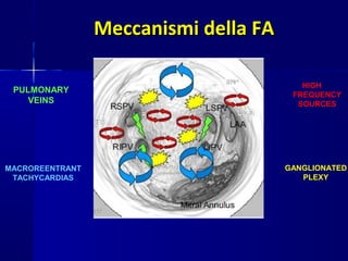 Meccanismi della FAMeccanismi della FA
PULMONARY
VEINS
MACROREENTRANT
TACHYCARDIAS
HIGH
FREQUENCY
SOURCES
GANGLIONATED
PLEXY
 