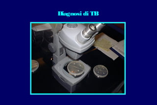 Diagnosi di TB
 