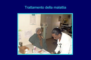 Trattamento della malattia
 