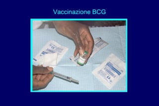 Vaccinazione BCG
 