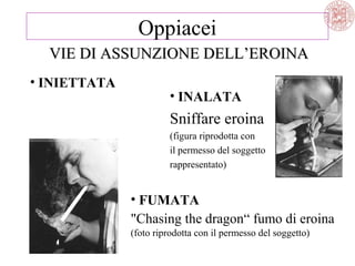 • INIETTATA
VIE DI ASSUNZIONE DELL’EROINAVIE DI ASSUNZIONE DELL’EROINA
Oppiacei
• FUMATA
"Chasing the dragon“ fumo di eroina
(foto riprodotta con il permesso del soggetto)
• INALATA
Sniffare eroina
(figura riprodotta con
il permesso del soggetto
rappresentato)
 