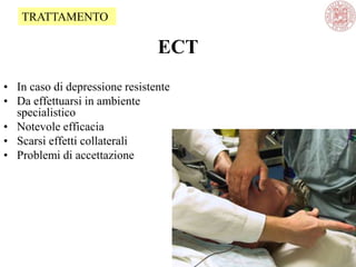 ECT
• In caso di depressione resistente
• Da effettuarsi in ambiente
specialistico
• Notevole efficacia
• Scarsi effetti collaterali
• Problemi di accettazione
TRATTAMENTO
 