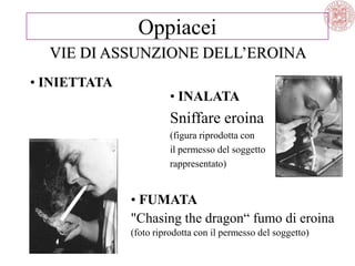• INIETTATA
VIE DI ASSUNZIONE DELL‘EROINA
Oppiacei
• FUMATA
"Chasing the dragon― fumo di eroina
(foto riprodotta con il permesso del soggetto)
• INALATA
Sniffare eroina
(figura riprodotta con
il permesso del soggetto
rappresentato)
 