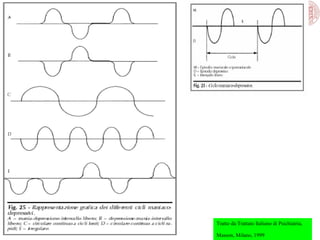 Tratto da:Trattato Italiano di Psichiatria,
Masson, Milano, 1999

 